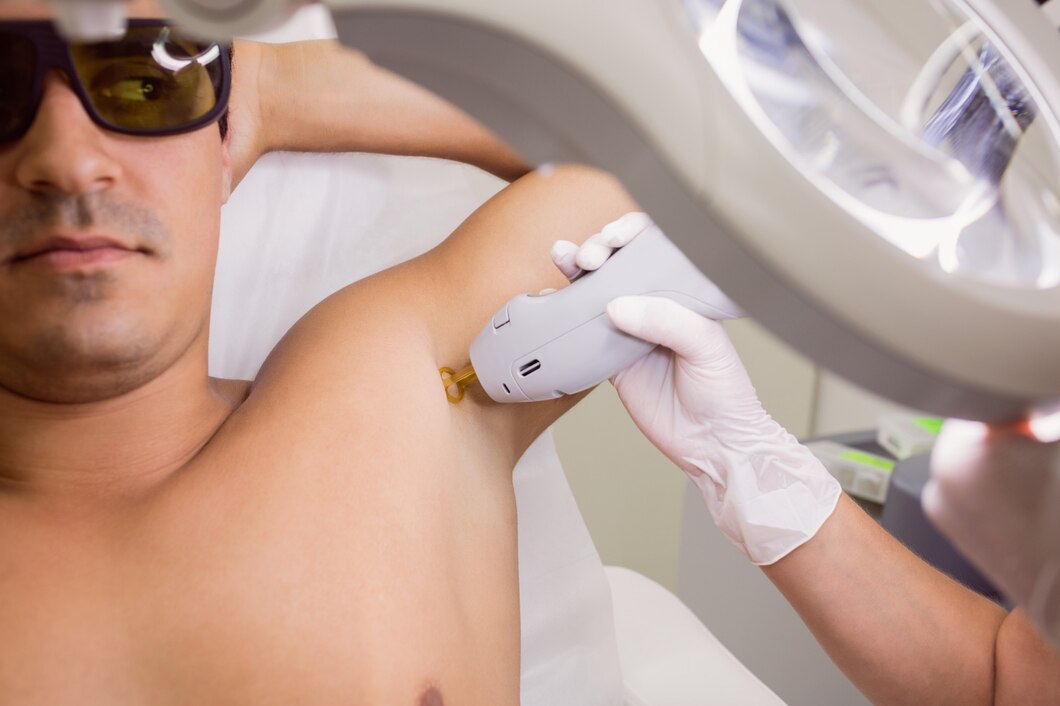 Zastosowanie lasera neodymowo-yagowego w usuwaniu naczyniaków – bezpieczna i skuteczna metoda walki z niedoskonałościami skóry